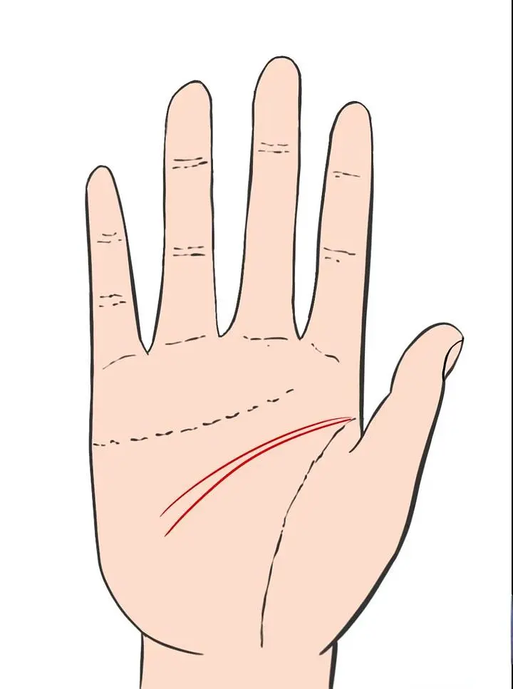 智慧线是链条纹_手相智慧线链条状_智慧线链条状手纹的人