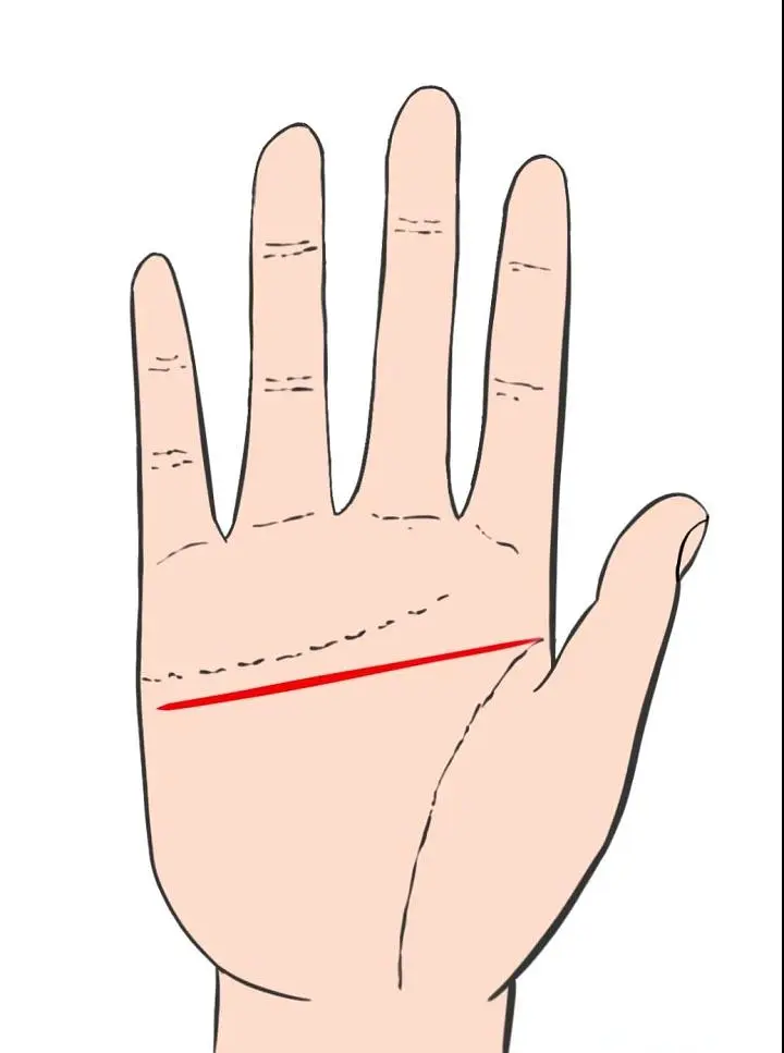 手相智慧线链条状_智慧线是链条纹_智慧线链条状手纹的人