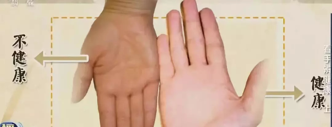 手掌金星丘凹陷代表什么原因_手掌金星丘凸起是什么_手掌金星丘凸起