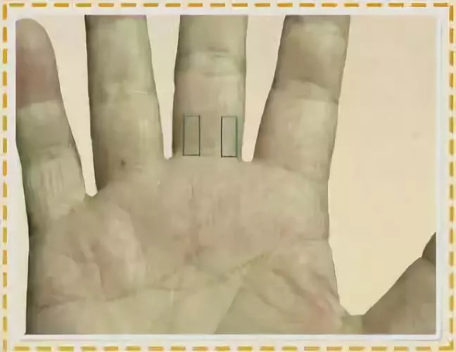 手掌金星丘凸起_手掌金星丘凸起是什么_手掌金星丘凹陷代表什么原因