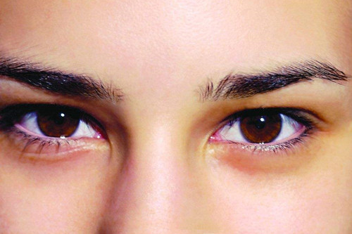 眼睛有疤痕面相图解_疤痕眼睛怎么样_疤痕眼睛面相图解有几种