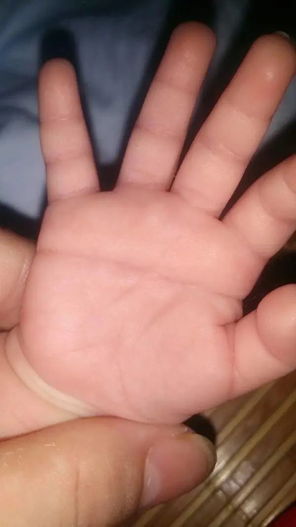 宝宝的手掌纹会变化吗_宝宝的手掌纹会变么_宝宝掌纹会变吗