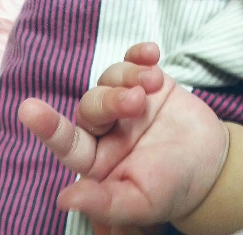 宝宝的手掌纹会变么_宝宝的手掌纹会变化吗_宝宝掌纹会变吗